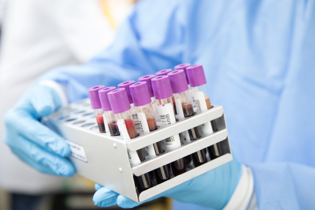 Biobank sverige